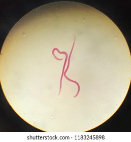 Trichinella Spiralis Adult In Light Microscope