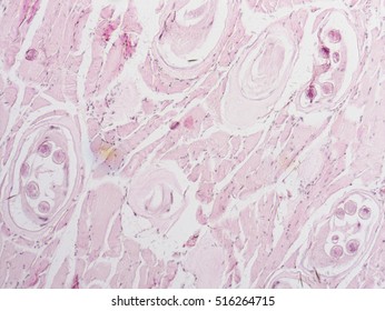 Trichinella Spiralis In Animal Tissue