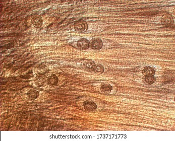 Trichinella Spiralis - Parasitic Worm Microscope