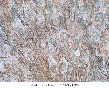 Trichinella Spiralis - Parasitic Worm Microscope