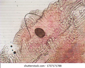 Trichinella Spiralis - Parasitic Worm Microscope