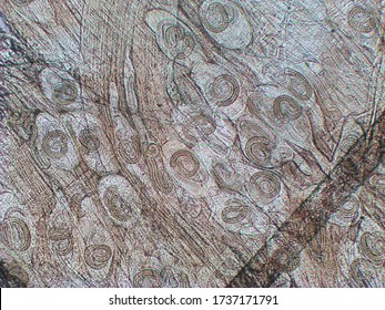 Trichinella Spiralis - Parasitic Worm Microscope