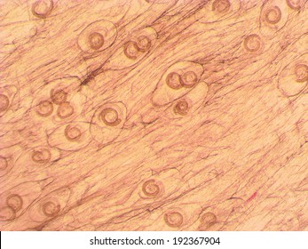 Trichinella Spiralis - Parasitic Worm Microscope