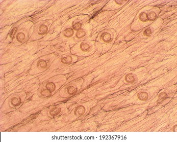 Trichinella Spiralis - Parasitic Worm Microscope