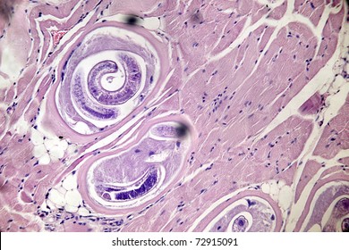 Trichinella Spiralis - Parasitic Worm In Muscle