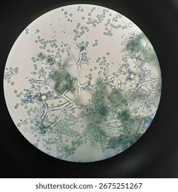 Trichoderma sp. under 400x microscope 