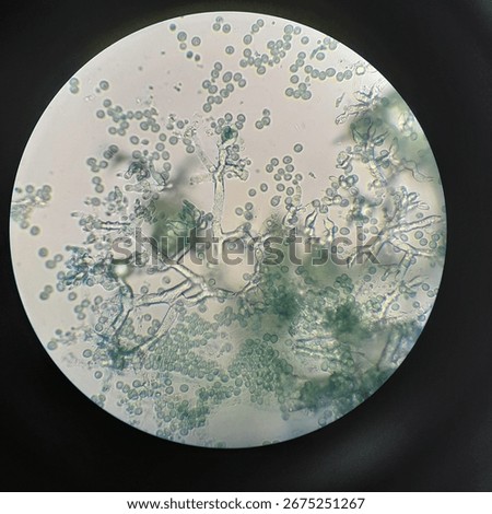 Trichoderma sp. under 400x microscope 