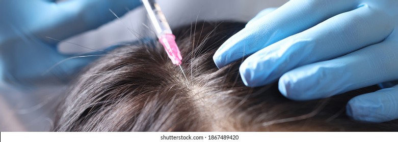 Trichologist Makes An Injection Into Scalp. Mesotherapy For Hair Growth Concept