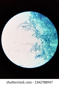 Trichophyton Rubrum Under Light Microscope