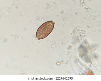 Trichuris Trichiura Egg