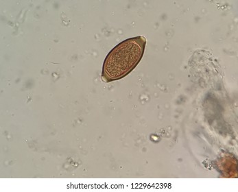 Trichuris Trichiura Egg