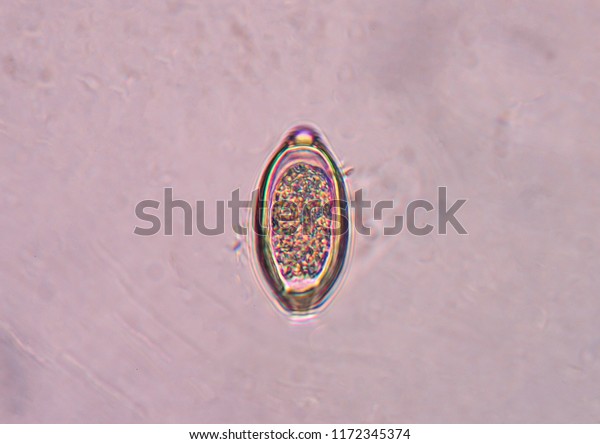 Trichuris Trichiura Egg Parasite Stock Photo 1172345374 | Shutterstock