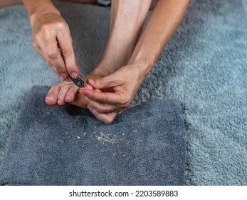 Trimming The Cuticles Of Toenails. Removal Of Old Skin On Toes.