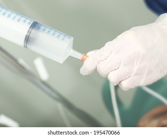 Tube Feeding In The Hospital 