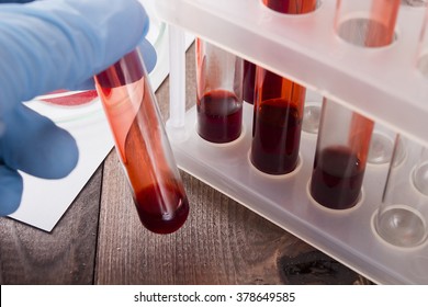 Tubes Of Blood Ã¢?? The Analysis On The Presence Of Contaminants, Disease Or Doping