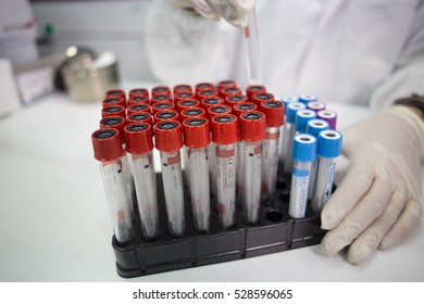 Tubes In The Hands Medical Laboratory Technologist