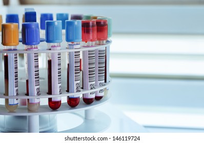 tubes prepared in lab centrifuge machine blood bank