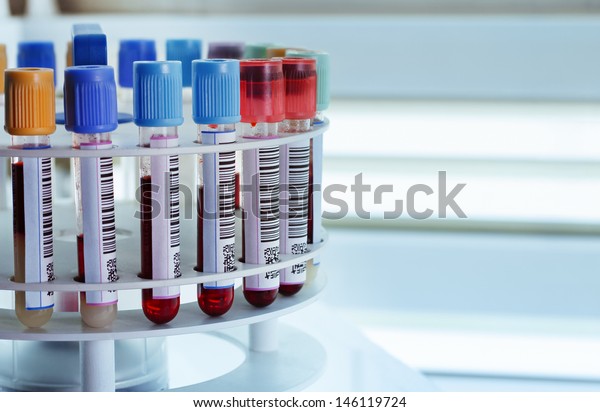 Tubes Prepared Lab Centrifuge Machine Blood Stock Photo (Edit Now ...