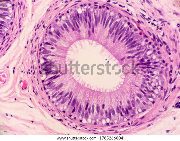 Tubules of the epididymis lined by ciliated\
epithelial cells and containing a few sperm which look like tiny\
dark dots. Microscopic view.\
Histology.