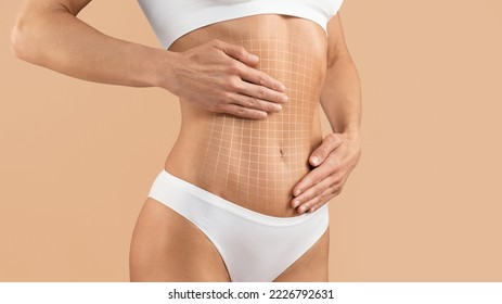 Tummy Tuck. Cropped Shot Of Female Body With Flat Abdomen And Drawn Mesh, Creative Collage With Unrecognizable Young Woman In Underwear Demonstrating Liposuction Or Plastic Surgery Result On Abs