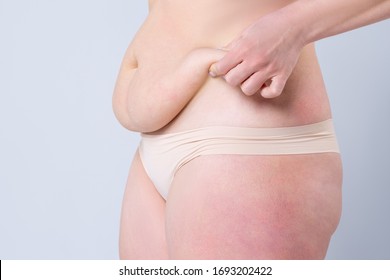 Tummy tuck, flabby skin on a fat belly, plastic surgery concept on gray background - Shutterstock ID 1693202422