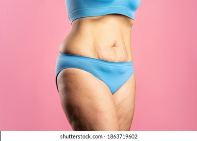 Tummy tuck, flabby skin on a fat belly, plastic surgery concept on pink background