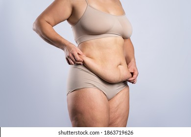 Tummy Tuck, Flabby Skin On A Fat Belly, Plastic Surgery Concept On Gray Background