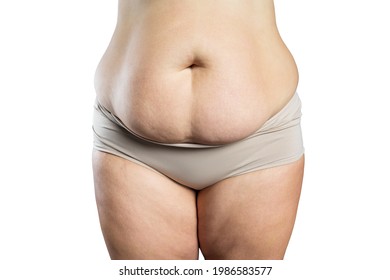 Tummy tuck, flabby skin on a fat belly, plastic surgery concept isolated on white background