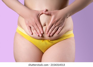 Tummy tuck, flabby skin on a fat belly, plastic surgery concept on lilac background