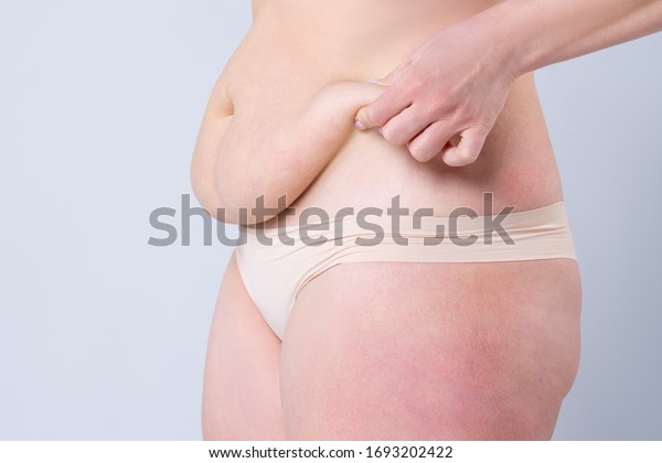 Tummy tuck, flabby skin on a fat belly,\
plastic surgery concept on gray\
background