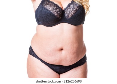 Tummy tuck, flabby skin with stretch marks on a fat belly, plastic surgery concept isolated on white background