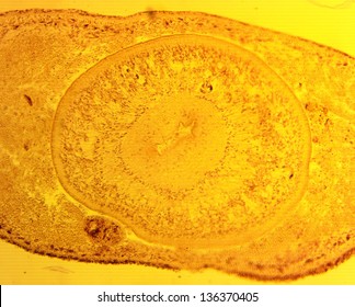 Turbellaria Worm Transverse Slit - Permanent Slide Plate Under High Magnification