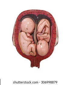 Twin Fetus Development In Womb Model