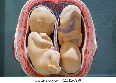 Twins Embryo Model, Fetus For Classroom Education.                               