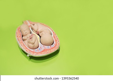 Twins Embryo Model. Fetus Human Model. Copy Space. Multiple Pregnancy.