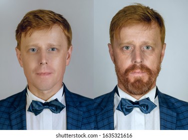 Two Different Photos Of The Same Ginger Bearded Man In Different Ages. Growing Up And Eldering Concept. Portrait Of Man In Younger And Elder Ages