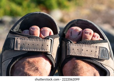 Two Dirty Feet After A Long Hike In Sandals. Dirty Toes Sticking Up From A Pair Of Sandals. The Right Big Toe Has An Ingrown Nail And A Bit Of Blood. Worn Sandlas And Feet After Summer Trail Adventure