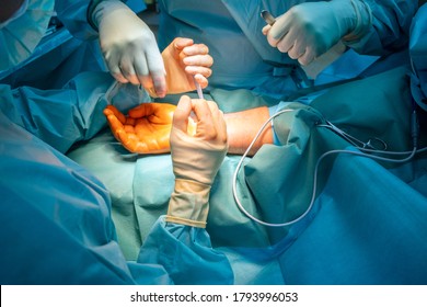 Two Doctors Operate On A Wrist Fracture In An Operating Theatre