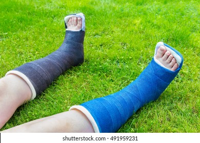 Two gypsum legs of child on grass - Powered by Shutterstock