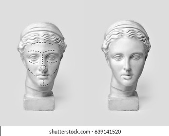 Two Marble Heads Of Young Women, Ancient Greek Goddess Bust Marked With Lines For Plastic Surgery And Sculpture After Operation On Light Background. Old And New Beauty Standarts Concept.