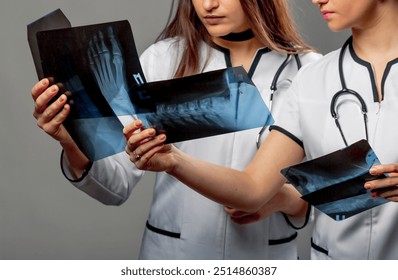 Two medical professionals examining X-ray images in a clinical setting. Two healthcare workers assess X-ray images together, highlighting collaboration in patient care. - Powered by Shutterstock