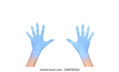 Two Opened Hands With Light Blue Color Of Young Man. Concept Of Cold And Clumsy Hand.