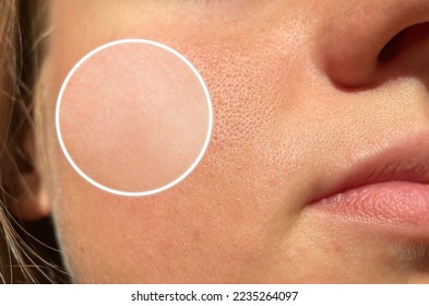 Two pictures compared effect Before and After treatment. Skin with problems of pore , dull skin and wrinkles before and after treatment to solve skin problem for better skin result - Shutterstock ID 2235264097