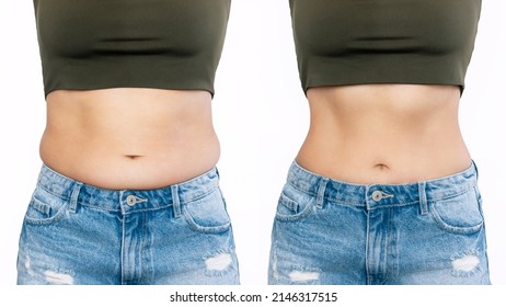 Two shots of a woman's belly with excess fat and toned slim stomach  before and after losing weight isolated on a white background. Result of diet, liposuction, training. Healthy lifestyle