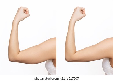 Two shots of a young woman with excess fat on her arm and toned arm before and after losing weight isolated on a white background. Result of diet, liposuction, training. Plastic surgery concept - Shutterstock ID 2146317507