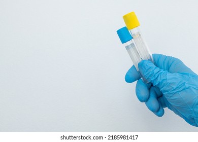 Two Vacuum Tubes For Collection And Blood Samples With Sodium Citrate In Blue Gloves For Laboratory. On White Background