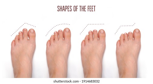 Types Of Foot Shape. Toe Shape. 