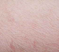 Typical Pink Pig Skin, Close-up.
