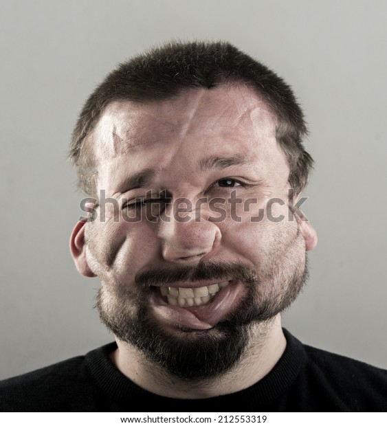 Ugly Man Fat Cheeks Beard Portrait Stock Image Download Now