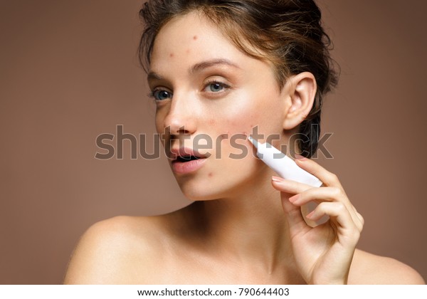 Ugly young girl with\
problem skin using treatment cream on beige background. Skin care\
concept